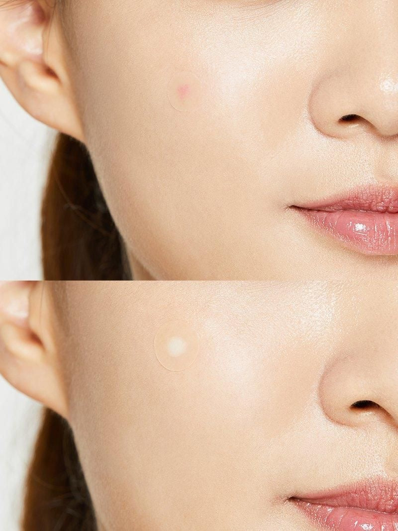 COSRX Acne Pimple Master Patch 24